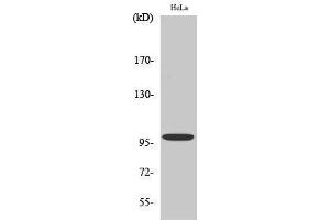 Western Blotting (WB) image for anti-Catenin (Cadherin-Associated Protein), alpha 1, 102kDa (CTNNA1) (C-Term) antibody (ABIN3183680)