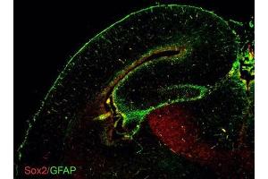IHC-Fr Image GFAP antibodies detects GFAP proteins on embryonic mouse brain by immunohistochemical analysis. (GFAP 抗体)