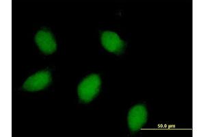Immunofluorescence of purified MaxPab rabbit antibody to CALB1 on HeLa cell. (CALB1 抗体  (AA 1-261))