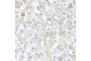 Immunohistochemistry of paraffin-embedded human liver injury using CETN1 antibody at dilution of 1:100 (x40 lens). (Centrin 1 抗体)