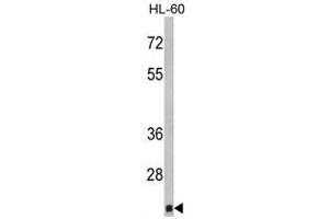 Image no. 1 for anti-Core-Binding Factor, beta Subunit (CBFB) (Middle Region) antibody (ABIN452819) (CBFB 抗体  (Middle Region))
