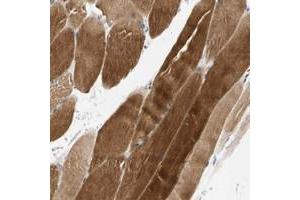 Immunohistochemical staining of human skeletal muscle with FAM198B polyclonal antibody  shows strong cytoplasmic positivity in myocytes. (FAM198B 抗体)