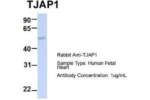 Host:  Rabbit  Target Name:  TJAP1  Sample Type:  Human Fetal Heart  Antibody Dilution:  1. (TJAP1 抗体  (N-Term))