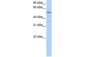 WB Suggested Anti-CHKA Antibody Titration: 0. (Choline Kinase alpha 抗体  (Middle Region))