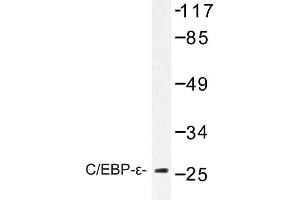 Image no. 1 for anti-CCAAT/enhancer Binding Protein (C/EBP), epsilon (CEBPE) antibody (ABIN272237) (CEBPE 抗体)