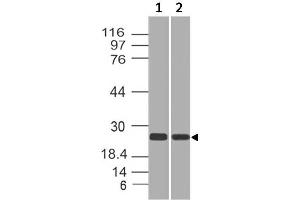 Image no. 1 for anti-RAP2A, Member of RAS Oncogene Family (RAP2A) antibody (ABIN5027782) (RAP2A 抗体)