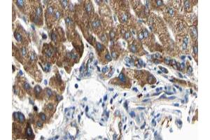 ABIN6266833 at 1/100 staining human liver tissue sections by IHC-P. (ARMCX3 抗体  (N-Term))