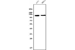 Western blot analysis of CD146/MCAM using anti-CD146/MCAM antibody (ABIN7602098).