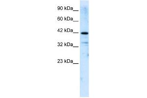 WB Suggested Anti-ZNF323 Antibody Titration:  2. (Zinc Finger and SCAN Domain Containing 31 (ZSCAN31) (Middle Region) 抗体)