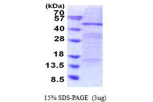 SDS-PAGE (SDS) image for Elongator Acetyltransferase Complex Subunit 4 (ELP4) (AA 1-424) protein (His tag) (ABIN5853922)
