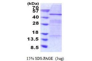 SDS-PAGE (SDS) image for Elongator Acetyltransferase Complex Subunit 4 (ELP4) (AA 1-424) protein (His tag) (ABIN5853922)
