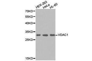 Western Blotting (WB) image for anti-Voltage-Dependent Anion Channel 1 (VDAC1) antibody (ABIN1875318) (VDAC1 抗体)
