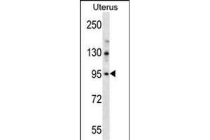 LRRC37B Antibody (C-term) (ABIN657113 and ABIN2846260) western blot analysis in human normal Uterus tissue lysates (35 μg/lane). (LRRC37B 抗体  (C-Term))