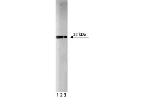 Western blot analysis of Cdk2 on a Jurkat lysate. (CDK2 抗体  (AA 109-298))