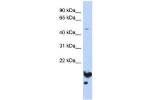 NUSAP1 antibody used at 1 ug/ml to detect target protein.
