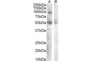 Western Blotting (WB) image for anti-Sulfatase 2 (SULF2) (AA 545-560) antibody (ABIN490407) (SULF2 抗体  (AA 545-560))