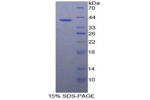 SDS-PAGE analysis of Rabbit VCAM1 Protein. (VCAM1 蛋白)