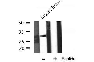 Western blot analysis of KCNMB2 expression in Mouse brain lysate