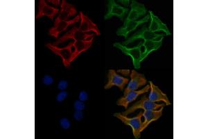 ABIN6259379 and ABIN6276140 staining Hela cells by IF/ICC.