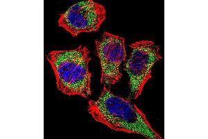 Fluorescent confocal image of Hela cell stained with CA2 Antibody (N-term) (ABIN652314 and ABIN2841442). (CA2 抗体  (N-Term))