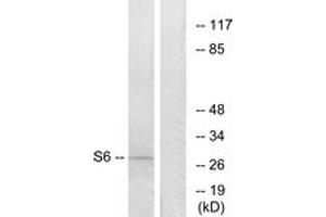 Western blot analysis of extracts from 293 cells, treated with serum 10% 15', using S6 Ribosomal Protein (Ab-235) Antibody. (RPS6 抗体  (AA 196-245))