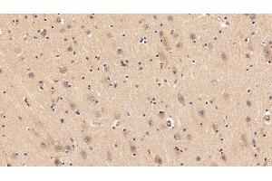 Detection of IGF1 in Porcine Cerebrum Tissue using Polyclonal Antibody to Insulin Like Growth Factor 1 (IGF1)
