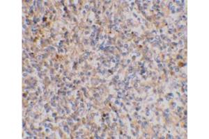 Immunohistochemical staining of human spleen tissue using AP30988PU-N at 2 μg/ml. (XAF1 抗体  (C-Term))