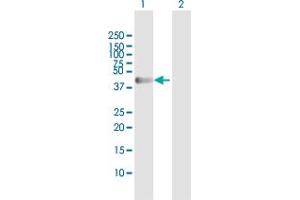 Western Blot analysis of NEK2 expression in transfected 293T cell line by NEK2 MaxPab polyclonal antibody. (NEK2 抗体  (AA 1-445))