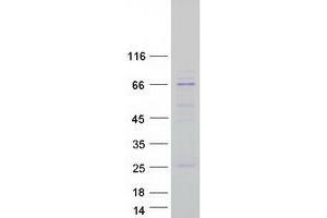 Western Blotting (WB) image for Solute Carrier Family 27 (Fatty Acid Transporter), Member 2 (SLC27A2) protein (Myc-DYKDDDDK Tag) (ABIN2732168)