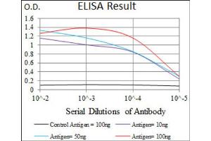ELISA image for anti-Surfactant Protein C (SFTPC) (AA 60-180) antibody (ABIN1846306)