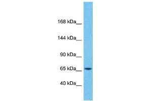 Host:  Rabbit  Target Name:  ZNF681  Sample Type:  Pancreas Tumor lysates  Antibody Dilution:  1. (ZNF681 抗体  (Middle Region))