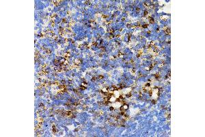 Immunohistochemistry (IHC) image for anti-Protein tyrosine Phosphatase, Non-Receptor Type 11 (PTPN11) (AA 514-593) antibody (ABIN3016707)