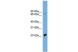 WB Suggested Anti-SLC5A5 Antibody Titration: 0.