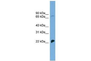 WB Suggested Anti-SLC5A5 Antibody Titration: 0. (SLC5A5 抗体  (N-Term))