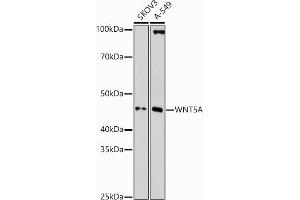 Western blot analysis of extracts of various cell lines, using WNT5A antibody (ABIN3023002, ABIN3023003, ABIN3023004 and ABIN6219340) at 1:1000 dilution.