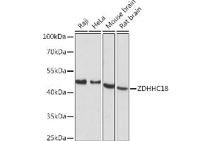 Western blot analysis of extracts of various cell lines, using ZDHHC18 Rabbit pAb (ABIN7271549) at 1:1000 dilution. (ZDHHC18 抗体  (AA 301-388))