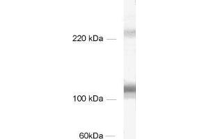 dilution: 1 : 1000, sample: rat brain homogenate (HCN1 抗体)