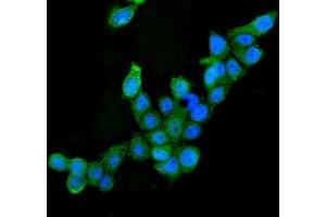 IF analysis of AIF using anti-AIF antibody (ABIN6719266).