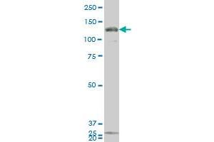 GUCY2C monoclonal antibody (M02), clone 1B11 Western Blot analysis of GUCY2C expression in 293 . (GUCY2C 抗体  (AA 24-133))