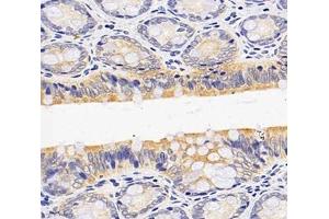 Immunohistochemistry analysis of paraffin-embedded rat colon using,OAS3 (ABIN7072846) at dilution of 1: 4000 (OAS3 抗体)