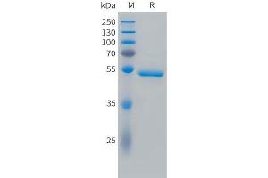 SDS-PAGE (SDS) image for Carbonic Anhydrase IX (CA9) (AA 38-398) protein (His tag) (ABIN7538160)