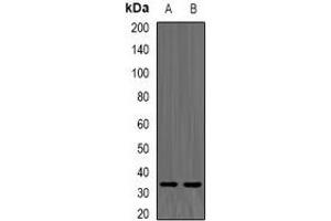 Western blot analysis of TPMT expression in K562 (A), mouse liver (B) whole cell lysates.
