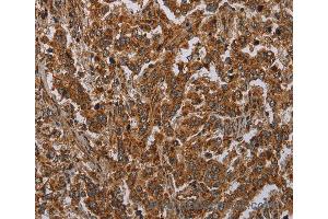 Immunohistochemistry of Human brain  using ATP2A1 Polyclonal Antibody at dilution of 1:30 (ATP2A1/SERCA1 抗体)
