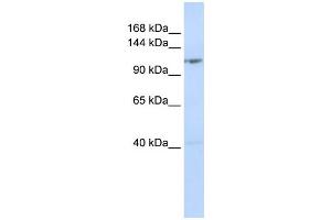 WB Suggested Anti-DDX46 Antibody Titration:  0. (DDX46 抗体  (Middle Region))