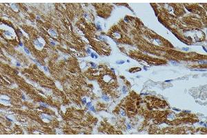 Immunohistochemistry of paraffin-embedded Mouse heart using FKBP1B Polyclonal Antibody at dilution of 1:100 (40x lens). (FKBP1B 抗体)