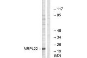 Western blot analysis of extracts from HepG2 cells, using MRPL22 Antibody.