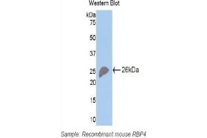 Detection of Recombinant RBP4, Mouse using Polyclonal Antibody to Retinol Binding Protein 4 (RBP4) (RBP4 抗体  (AA 63-245))