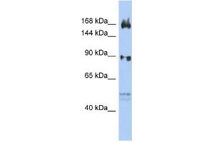 Human OVCAR3; WB Suggested Anti-AFF2 Antibody Titration: 0. (AFF2 抗体  (N-Term))