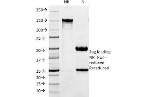 SDS-PAGE Analysis Purified CD171 Mouse Monoclonal Antibody (SPM275). (L1CAM 抗体)
