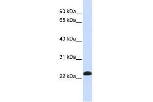 Western Blot showing CAV2 antibody used at a concentration of 1-2 ug/ml to detect its target protein. (Caveolin 2 抗体  (N-Term))